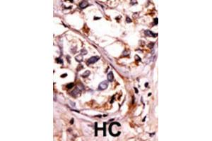 Immunohistochemistry (IHC) image for anti-Spleen tyrosine Kinase (SYK) (pThr526), (pTyr526) antibody (ABIN2913440) (SYK 抗体  (pThr526, pTyr526))
