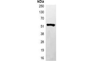 Immunoprecipitation of His-tagged protein from HEK293T cells transfected with vector overexpressing His tag, using Anti-His-tag Antibody. (His Tag 抗体)