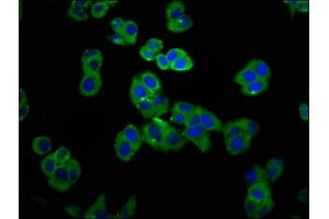 Immunofluorescence staining of PC-3 cells with ABIN7153683 at 1:100, counter-stained with DAPI. (GRPR 抗体  (AA 326-384))