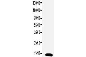 Anti-Estrogen Inducible Protein Ps2 antibody, Western blotting WB: MCF-7 Cell Lysate (TFF1 抗体  (Middle Region))