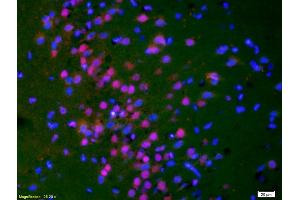Formalin-fixed and paraffin-embedded rat brain labeled with Anti-Phospho-HER3 (Tyr1289) Polyclonal Antibody, Unconjugated (ABIN747113) 1:200, overnight at 4°C, The secondary antibody was Goat Anti-Rabbit IgG, Cy3 conjugated used at 1:200 dilution for 40 minutes at 37°C. (ERBB3 抗体  (pTyr1289))