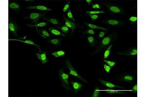 Immunofluorescence (IF) image for anti-Arachidonate 5-Lipoxygenase (ALOX5) (AA 1-674) antibody (ABIN513267)