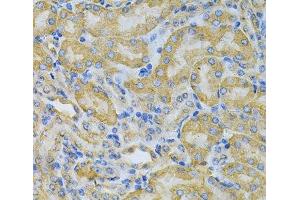 Immunohistochemistry of paraffin-embedded Mouse kidney using PGK1 Polyclonal Antibody at dilution of 1:100 (40x lens). (PGK1 抗体)