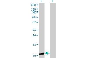 Western Blot analysis of GTF2A2 expression in transfected 293T cell line by GTF2A2 monoclonal antibody (M01), clone 2B9. (GTF2A2 抗体  (AA 1-109))