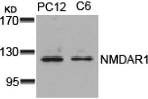 Image no. 1 for anti-NMDA Receptor 1 (NMDA R1) (AA 894-898) antibody (ABIN319312) (NMDA 1 Receptor 抗体  (AA 894-898))