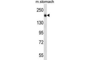 Western Blotting (WB) image for anti-Unc-13 Homolog B (UNC13B) antibody (ABIN2997152) (UNC13B 抗体)