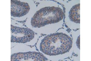 Immunohistochemistry (IHC) image for anti-Phospholipase A2, Group IIA (Platelets, Synovial Fluid) (PLA2G2A) (AA 22-146) antibody (ABIN1860250)