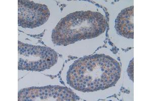 Used in DAB staining on fromalin fixed paraffin- embedded testis tissue (PLA2G2A 抗体  (AA 22-146))