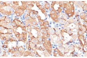 Immunohistochemistry of paraffin-embedded Human stomach using NHLRC1 Polyclonal Antibody at dilution of 1:100 (40x lens). (NHLRC1 抗体)