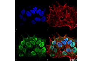 Immunocytochemistry/Immunofluorescence analysis using Mouse Anti-SHANK1/SHANK3 Monoclonal Antibody, Clone S367-51 . (SHANK3 抗体  (AA 538-626) (Atto 594))