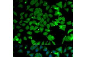 Immunofluorescence analysis of U2OS cells using NAA10 Polyclonal Antibody (NAA10 抗体)