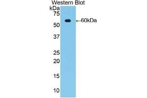 Detection of Recombinant MUC1, Rat using Polyclonal Antibody to Mucin 1 (MUC1) (MUC1 抗体  (AA 404-655))