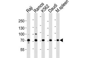 Western blot analysis of lysate from Raji, Ramos, K562, Daudi cell line and mouse spleen tissue lysate using BTK antibody at 1:1000. (BTK 抗体  (AA 396-430))