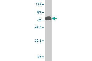 Western Blot detection against Immunogen (76. (MLLT6 抗体  (AA 1-462))