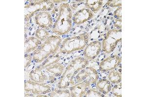 Immunohistochemistry of paraffin-embedded rat kidney using RNF166 antibody. (RNF166 抗体)