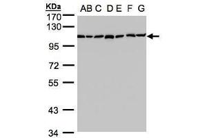 WB Image Sample(30 ug whole cell lysate) A: 293T B: A431 , C: H1299 D: HeLa S3 , E: Hep G2 , F: MOLT4 , G: Raji , 7. (GANAB 抗体  (N-Term))