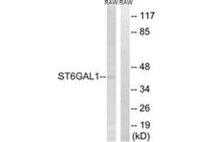 Western blot analysis of extracts from RAW264. (ST6GAL1 抗体  (AA 171-220))