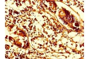 Immunohistochemistry of paraffin-embedded human appendix tissue using ABIN7170841 at dilution of 1:100 (SMAP1 抗体  (AA 1-280))