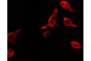 Immunofluorescence (fixed cells) (IF/ICC) image for anti-Tumor Necrosis Factor Receptor Superfamily, Member 1B (TNFRSF1B) (C-Term) antibody (ABIN6256994)