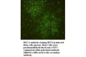 Image no. 1 for anti-Herpes Simplex Virus Type 1 (HSV1) antibody (ABIN791168) (Herpes Simplex Virus Type 1 (HSV1) 抗体)