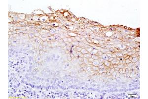 Formalin-fixed and paraffin embedded rat kidney tissue labeled with Rabbit Anti-Notch 2 Polyclonal Antibody, Unconjugated (ABIN680183) at 1:200 followed by conjugation to the secondary antibody and DAB staining. (NOTCH2 抗体  (AA 1501-1700))