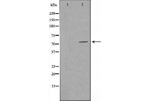 Western blot analysis of extracts from COLO cells, using GPR114 antibody. (GPR114 抗体  (Internal Region))