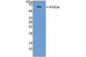 Detection of Recombinant MR, Human using Polyclonal Antibody to Mineralocorticoid Receptor (MR) (NR3C2 抗体  (AA 739-984))