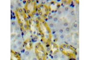 Used in DAB staining on fromalin fixed paraffin-embedded Kidney tissue (ALDH1A3 抗体  (AA 332-509))