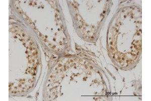 Image no. 1 for anti-DNA Methyltransferase 1-Associated Protein 1 (DMAP1) (AA 1-101) antibody (ABIN599578) (DMAP1 抗体  (AA 1-101))