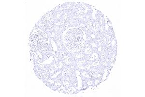 kidney cortex (Recombinant KRT20 抗体  (AA 196-323))
