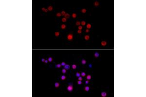 Immunofluorescence analysis of Neuro-2a cells using Nestin Rabbit pAb (ABIN6128335, ABIN6144536, ABIN6144537 and ABIN6215496) at dilution of 1:50 (40x lens). (Nestin 抗体  (AA 1392-1621))
