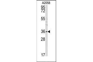 Western blot analysis of anti-ANXA2 Antibody (C-term) in A2058 cell line lysates (35ug/lane). (Annexin A2 抗体  (C-Term))