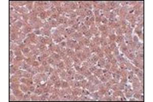 Immunohistochemistry of JMJD2A in rat liver tissue with this product at 5 μg/ml. (KDM4A 抗体  (Center))