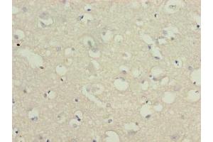 Immunohistochemistry of paraffin-embedded human brain tissue using ABIN7174836 at dilution of 1:100 (C3orf18 抗体  (AA 83-162))