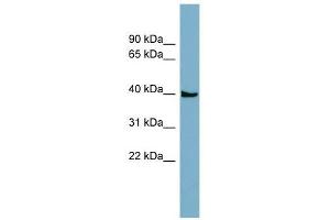 SLC35D3 antibody used at 1 ug/ml to detect target protein.