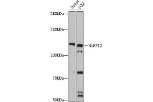Western blot analysis of extracts of various cell lines, using NLRP12 antibody (ABIN7268938) at 1:3000 dilution. (NLRP12 抗体  (AA 862-1062))