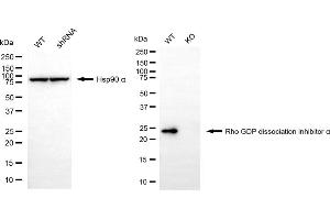 Western blotting analysis using Rho GDP dissociation inhibitor alpha antibody (ABIN7800196). (ARHGDIA 抗体)