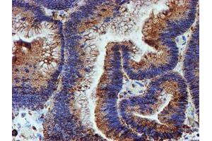Immunohistochemistry (IHC) image for anti-Protein Disulfide Isomerase Family A, Member 4 (PDIA4) antibody (ABIN1500110) (PDIA4 抗体)