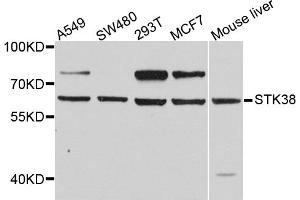 Western blot analysis of extracts of various cell lines, using STK38 antibody (ABIN5974655) at 1/1000 dilution. (STK38 抗体)