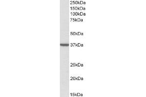 ABIN2560487 (2µg/ml) staining of Human Frontal Cortex lysate (35µg protein in RIPA buffer). (TOMM40 抗体  (Internal Region))