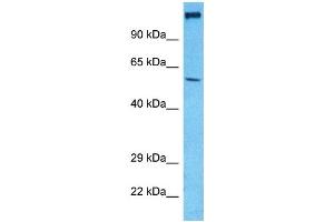 Host:  Rabbit  Target Name:  VGLU1  Sample Type:  HepG2 Whole Cell lysates  Antibody Dilution:  1ug/ml