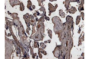 Immunohistochemistry (IHC) image for anti-Plasminogen Activator, Urokinase (PLAU) (C-Term) antibody (ABIN185470)