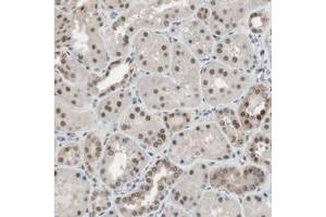 Immunohistochemical staining of human kidney with LONP2 polyclonal antibody  shows strong nuclear and weak cytoplasmic positivity in cells in tubules. (LONP2 抗体)