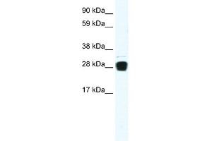 WB Suggested Anti-TNFSF12 Antibody Titration:  0. (TWEAK 抗体  (N-Term))