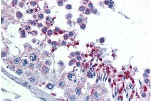 Human Testis: Formalin-Fixed, Paraffin-Embedded (FFPE) (GMP Synthase 抗体  (AA 108-216))