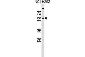 ZDHHC13 Antibody (N-term) western blot analysis in NCI-H292 cell line lysates (35 µg/lane). (ZDHHC13 抗体  (N-Term))