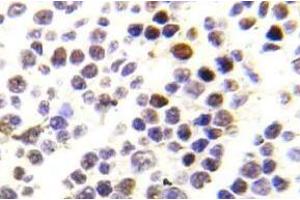 Immunohistochemistry (IHC) analyzes of p-Histone H3. (Histone H3.1 抗体  (pSer28))
