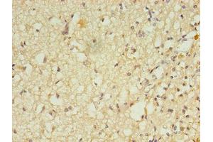 Immunohistochemistry of paraffin-embedded human brain tissue using ABIN7167621 at dilution of 1:100 (RGS7 抗体  (AA 1-487))