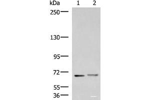 Western blot analysis of Mouse brain tissue and Human cerebrum tissue lysates using EXD2 Polyclonal Antibody at dilution of 1:700 (EXD2 抗体)