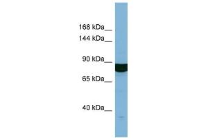 Host:  Rabbit  Target Name:  HACE1  Sample Type:  OVCAR-3 Whole cell lysates  Antibody Dilution:  1. (HACE1 抗体  (N-Term))